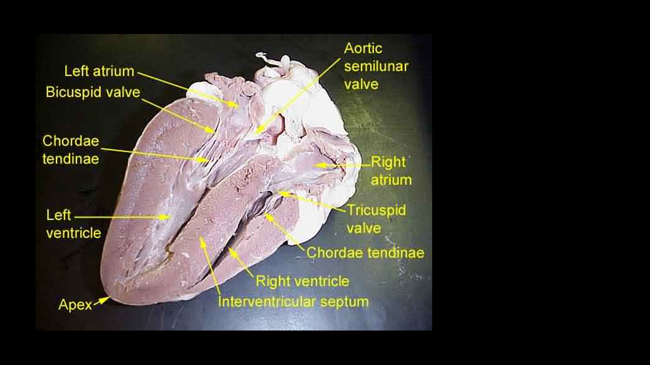 HEART DISSECTION PHOTO GALLERY - SCIENTIST CINDY