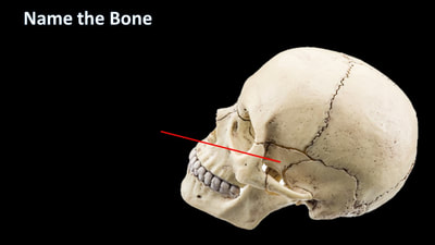 temporal process of zygomatic bone