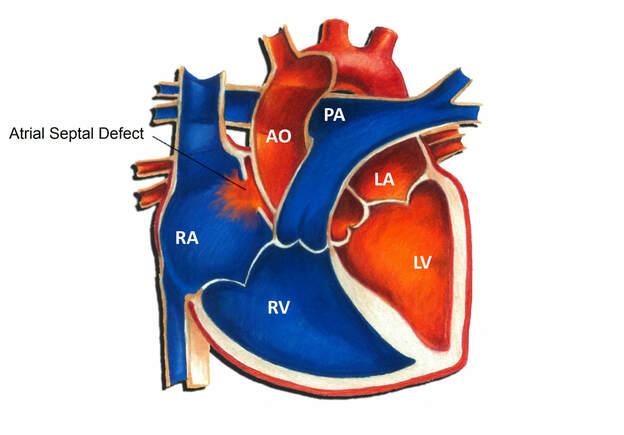 Heart Rate, Blood Pressure, Electrocardiogram Lab - SCIENTIST CINDY
